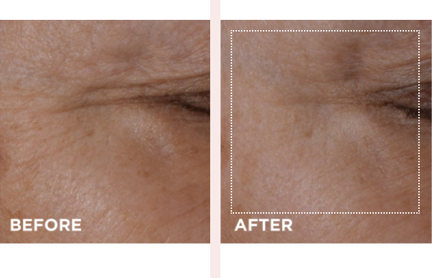 How to Use Visibly Naturally Eyes to Eye Lift Lift How Total Clarins | 